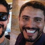 Dentista &eacute; denunciado pelo MP por transmiss&atilde;o intencional de HIV; quatro v&iacute;timas j&aacute; tiveram contamina&ccedil;&atilde;o confirmada