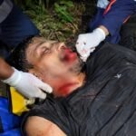 Homem é encontrado gravemente ferido, com língua cortada e perfuração no pescoço